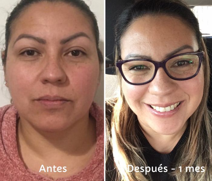 Antes y Después – 1 mes