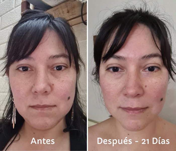Antes y Después – 21 días