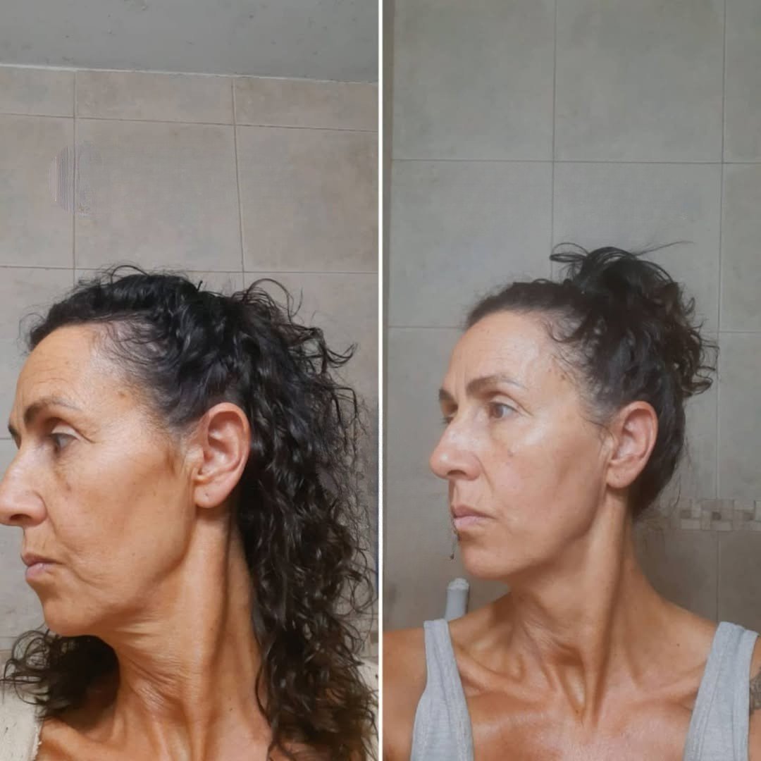 Antes y Después – perfil